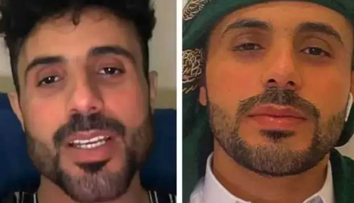 من فنان وسيم إلى “كرسي سيكل”.. تعليقات ساخرة تلاحق عمار العزكي بعد التجميل