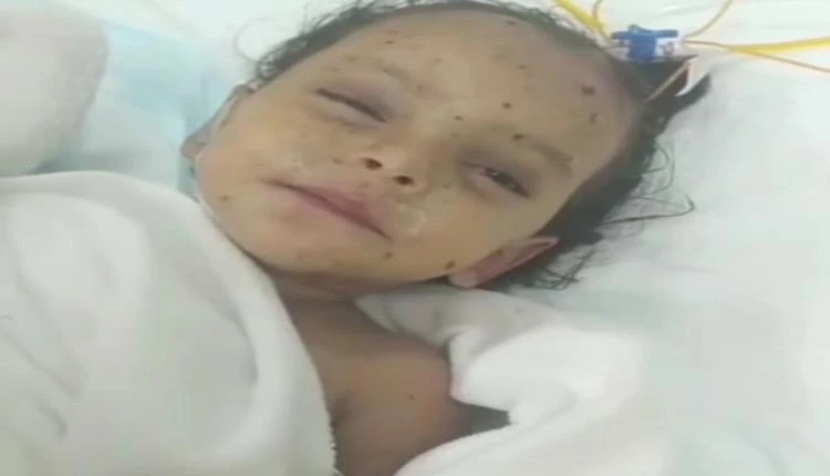 من تحت ركام المجزرة إلى الحياة.. الطفلة أسماء تغادر العناية بعد نجاتها من مجزرة إفطار حيران