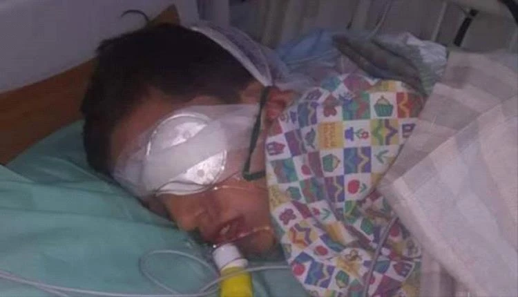 صنعاء تحت القصف الصامت.. تجار الحوثي يغرقون العاصمة بألعاب الموت وسقوط عشرات الجرحى