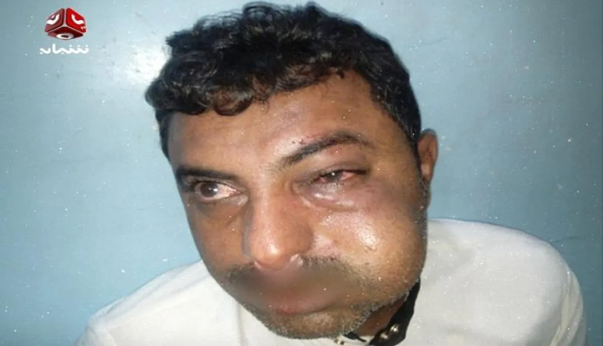 قيادي حوثي يعتدي على محامٍ في الحديدة