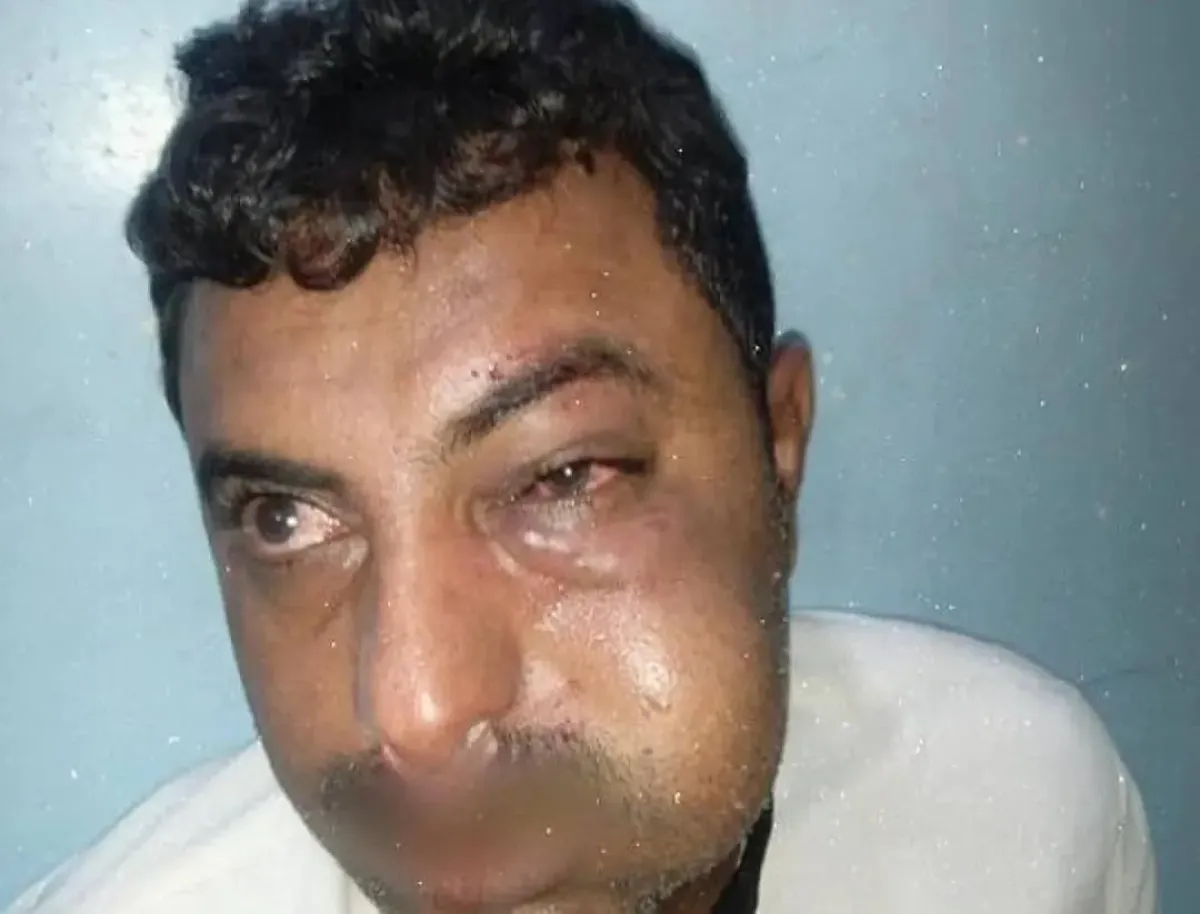 قيادي حوثي يعتدي على محامٍ في الحديدة وسط استمرار استهداف منظومة القانون