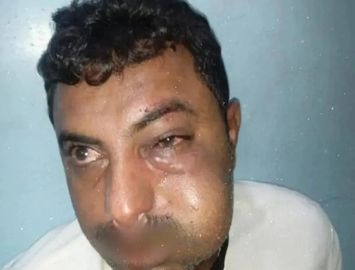 قيادي حوثي يعتدي على محامٍ في مدينة زبيد بمحافظة الحديدة