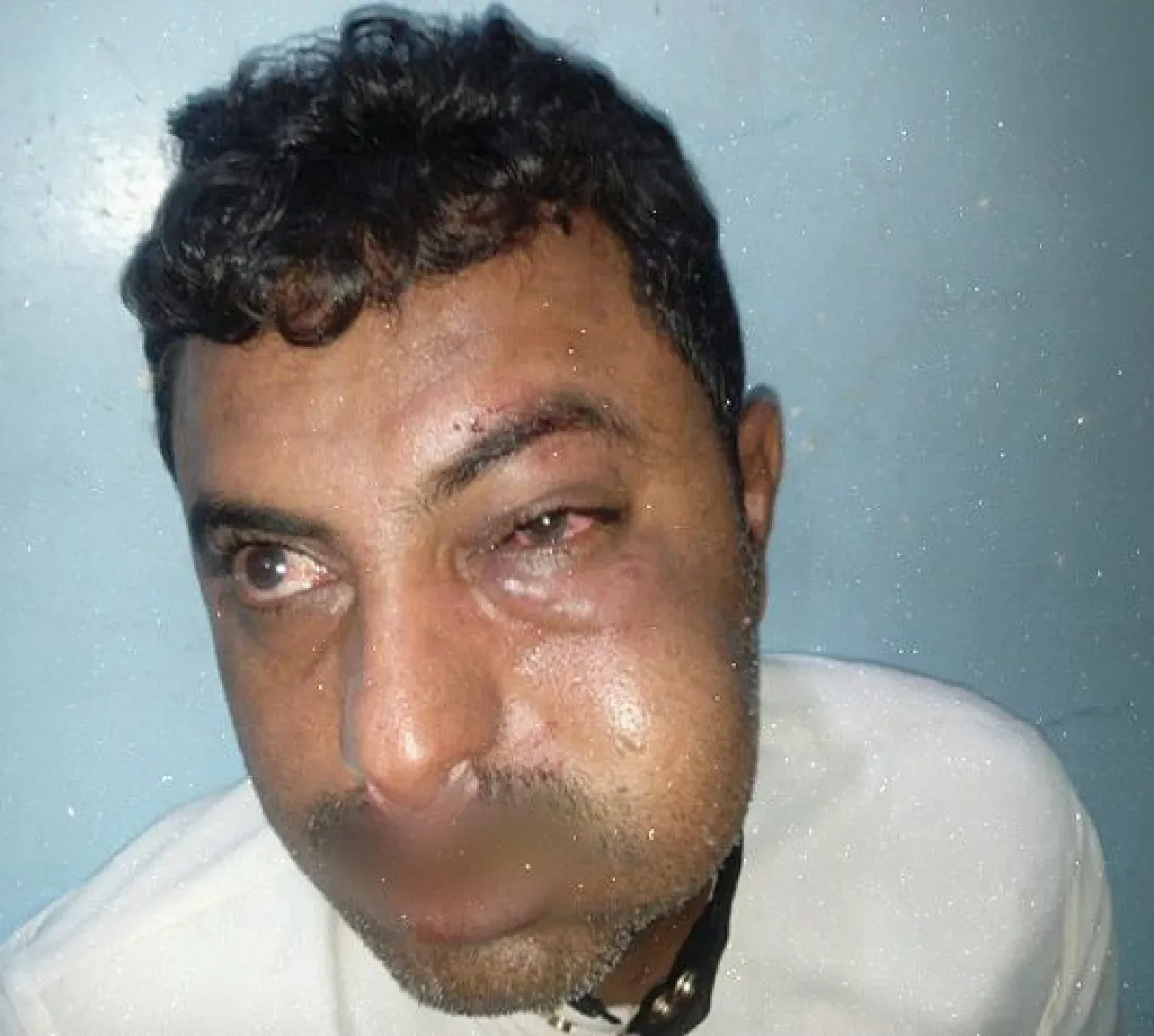 قيادي حوثي يعتدي على محامٍ في الحديدة وسط تصاعد الانتهاكات