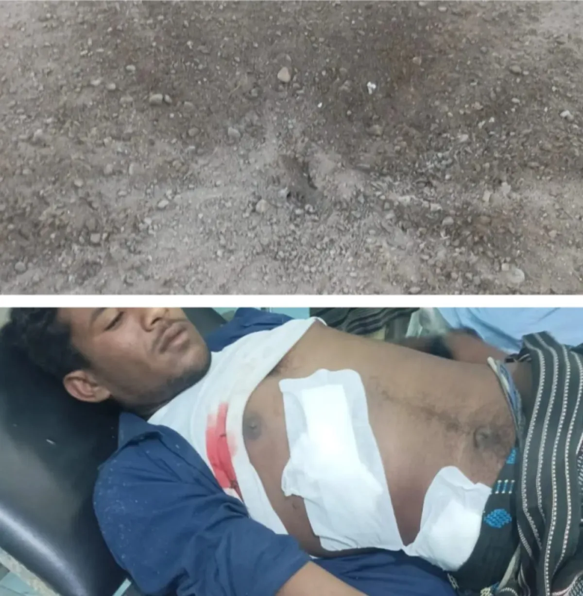 بقذائف الهاون.. مليشيا الحوثي تستهدف مخيماً للنازحين جنوبي الحديدة وتصيب مدنياً بجروح بليغة