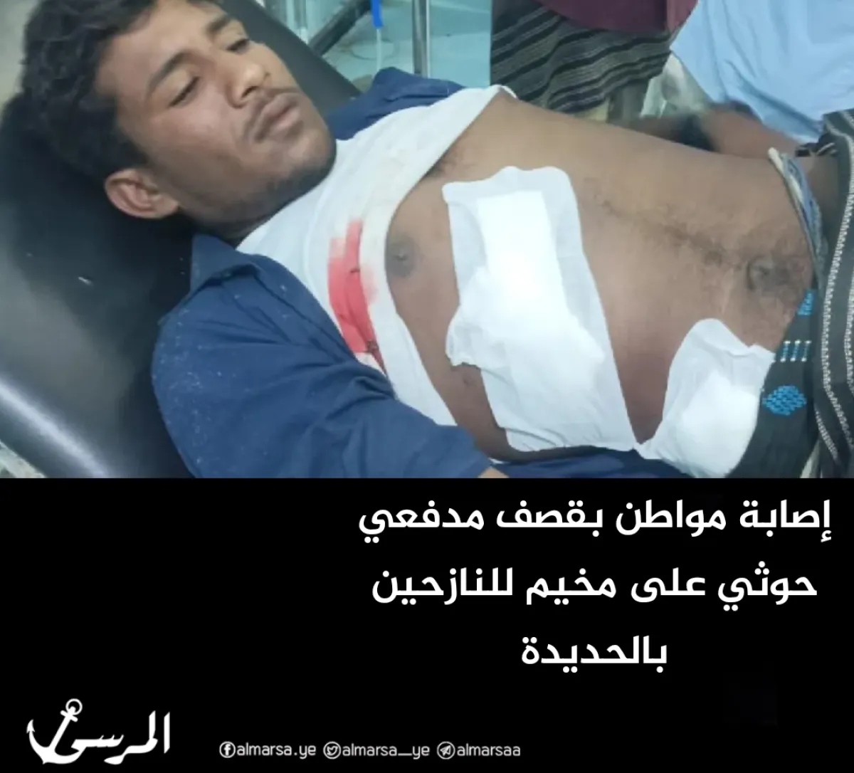 إصابة مواطن بقصف مدفعي حوثي على مخيم للنازحين بالحديدة