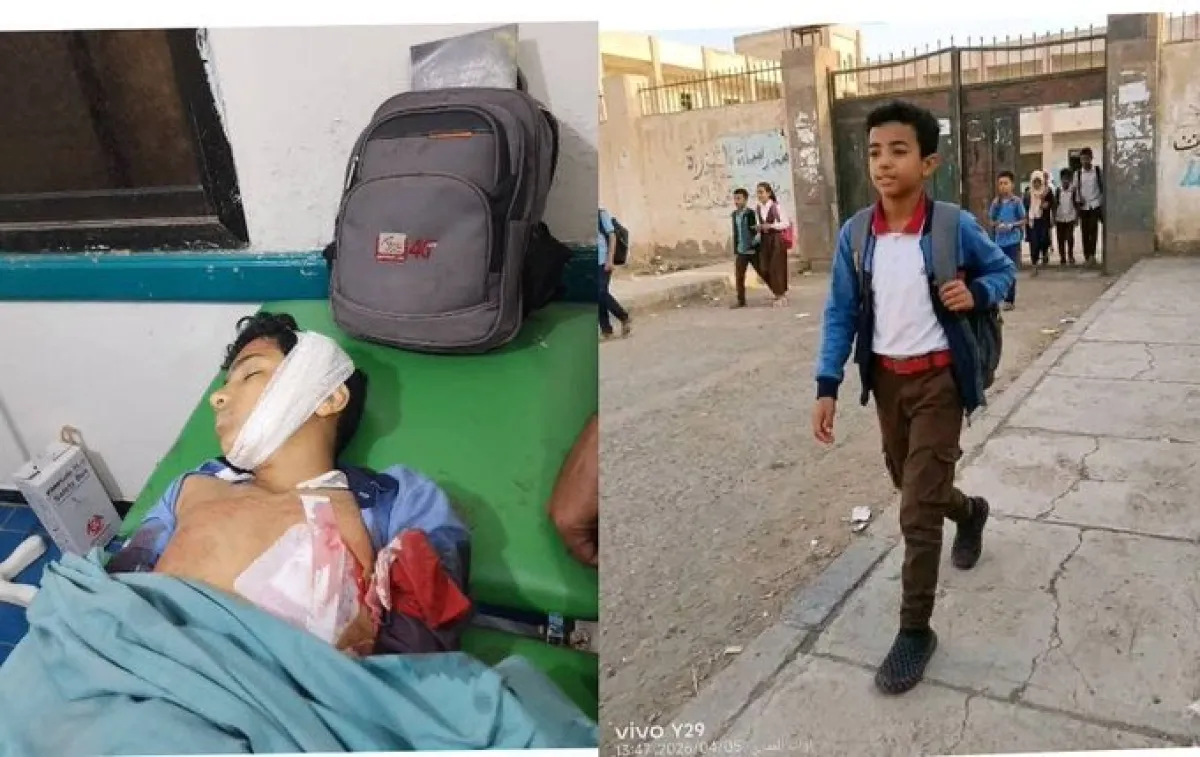 استشهاد طفل برصاص قناص حوثي في تعز