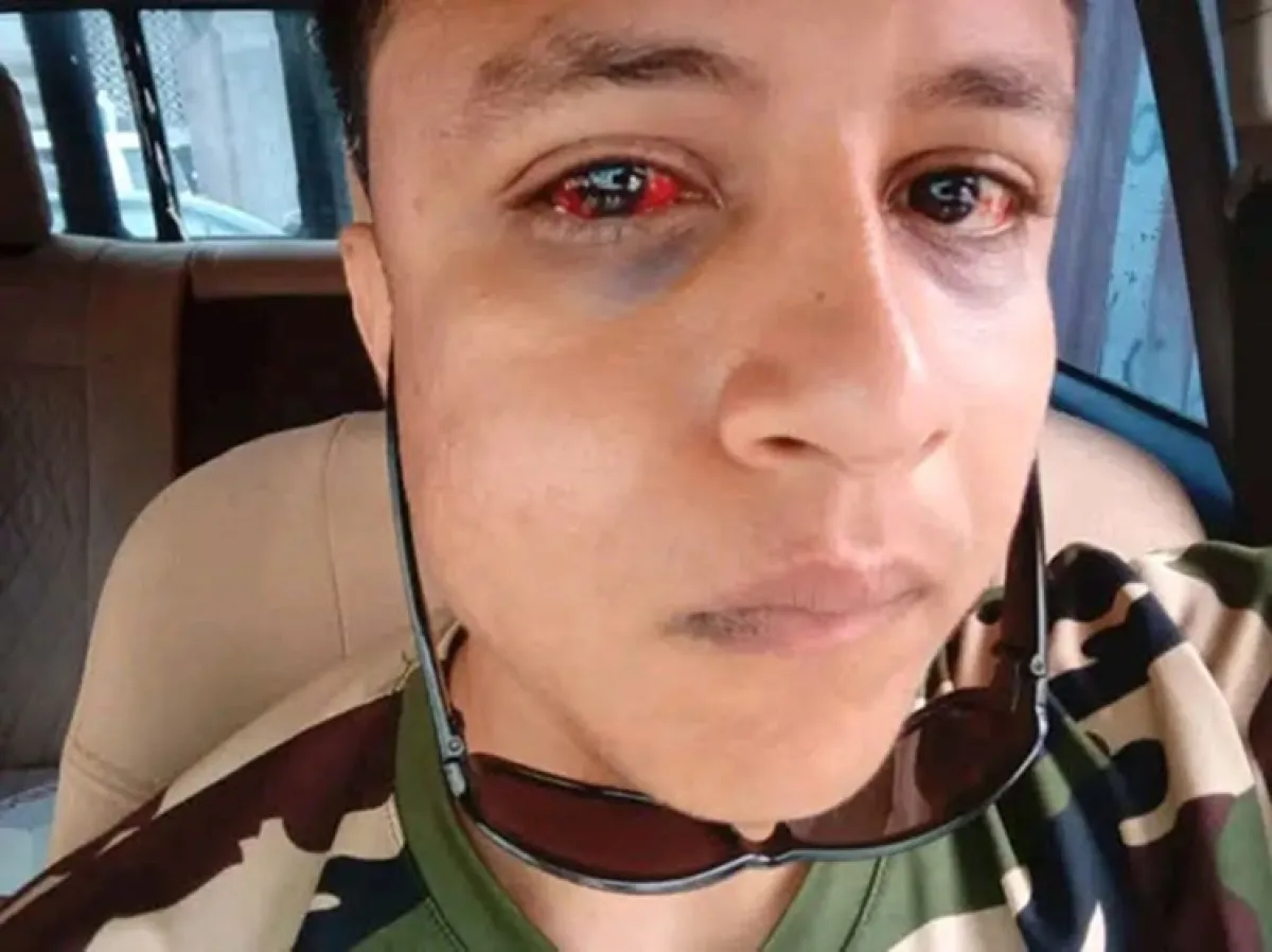 شهادة صادمة: شاب يروي تفاصيل تعذيبه وإصابته داخل قسم شرطة في عدن