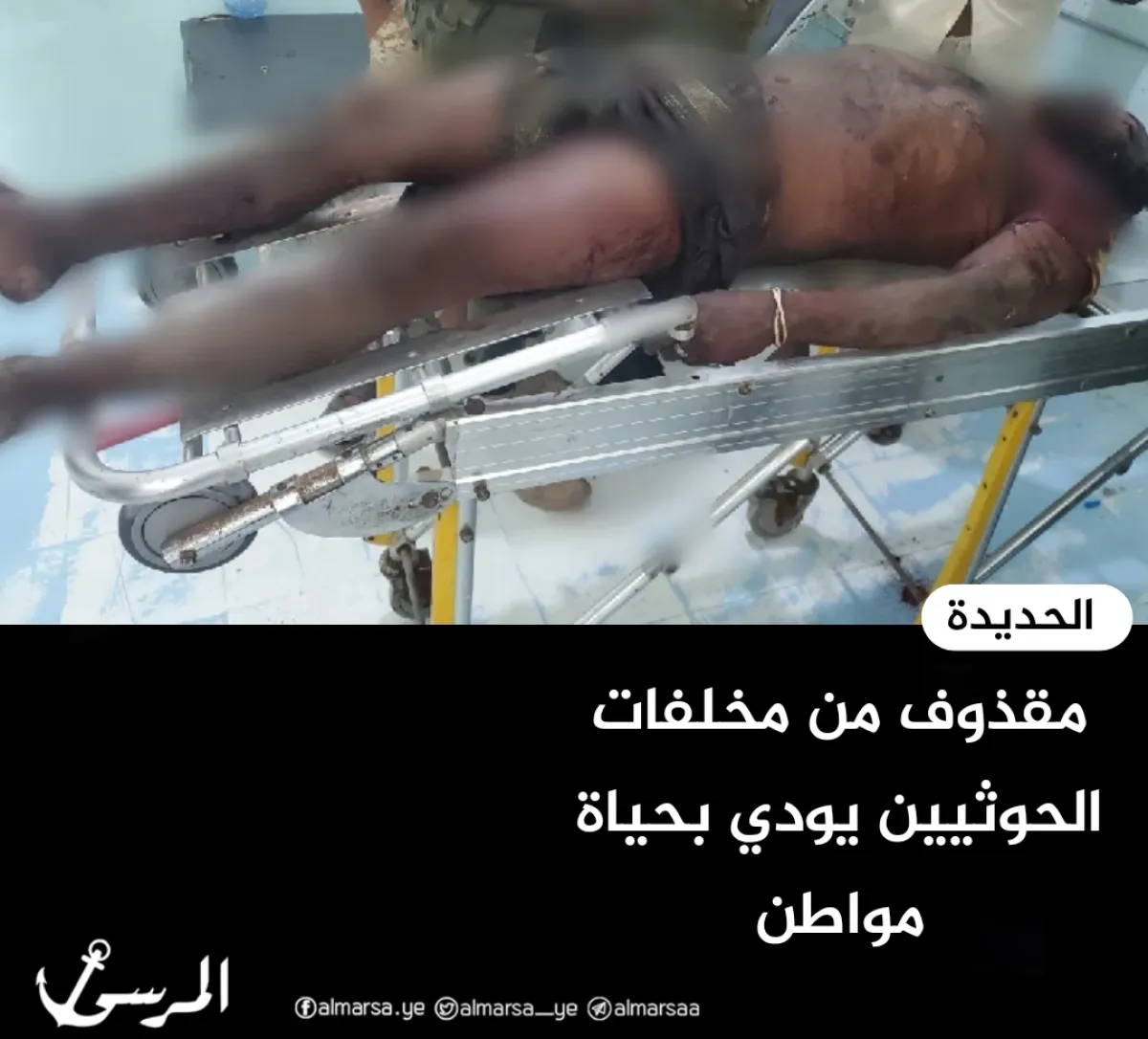 مقذوف من مخلفات الحوثيين يودي بحياة مواطن في الحديدة