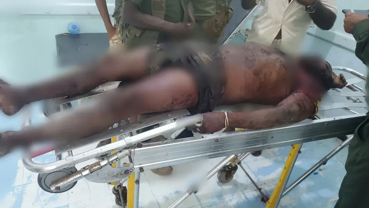 مقتل مواطن بانفجار مقذوف من مخلفات مليشيا الحوثي في الخوخة
