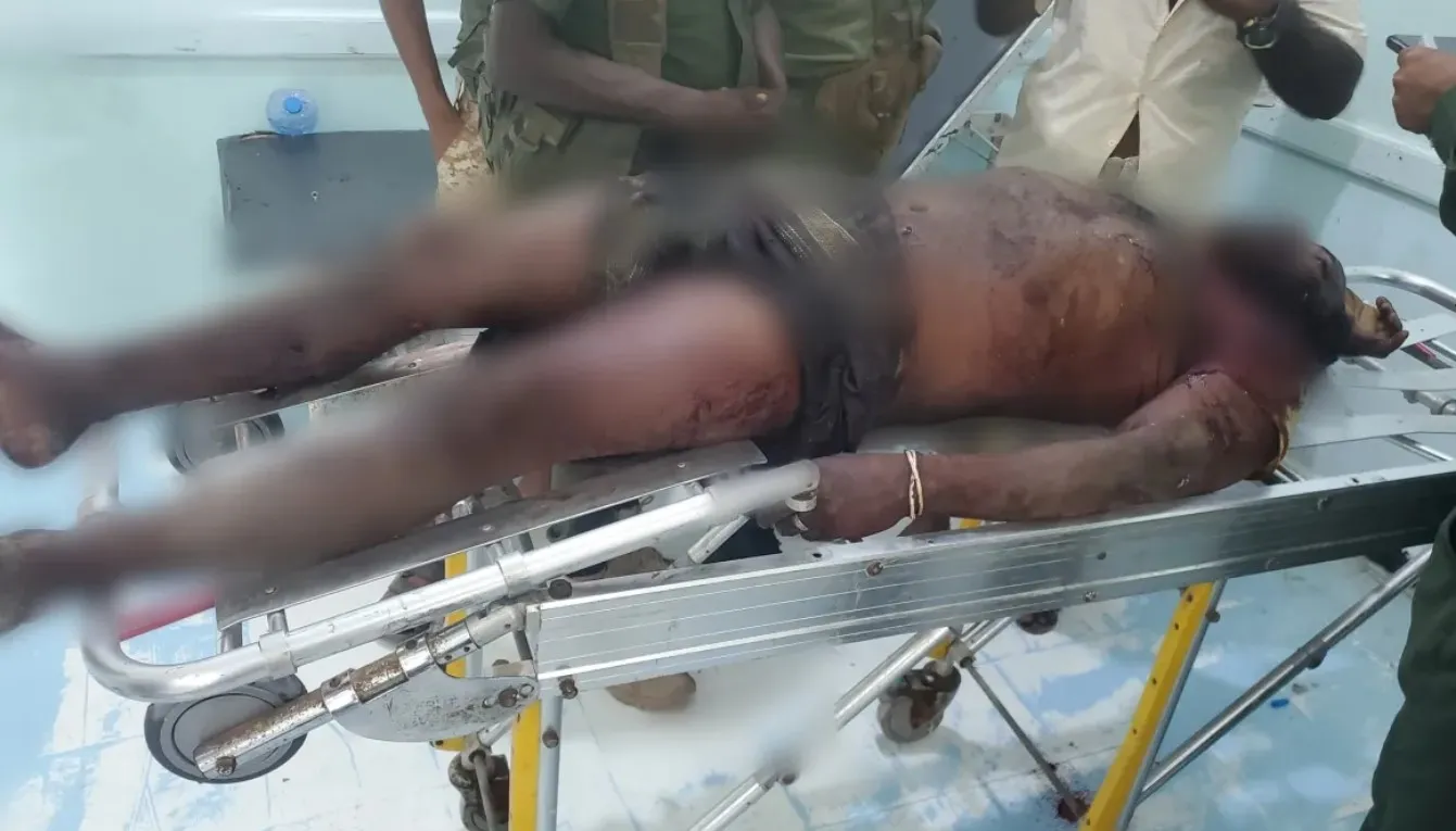 مقتل مواطن بانفجار مقذوف من مخلفات الحوثيين في “الخوخة” جنوبي الحديدة