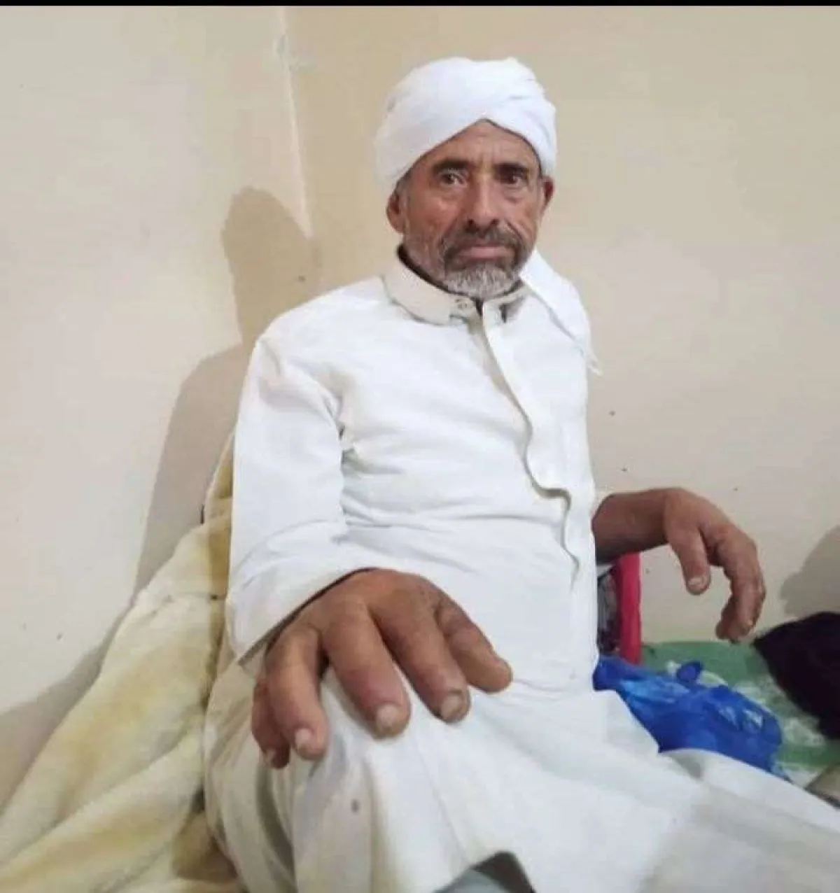تحت تهديد السلاح وبوسط المدينة .. اعتداء وحشي على مواطن في تعز وغياب أمني مُريب