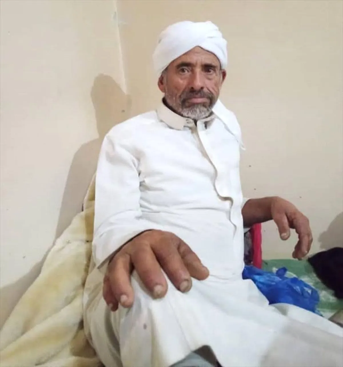 تعز .. عصابة مسلحة تنهب مواطناً وتتركه في غيبوبة بـساحة الحرية