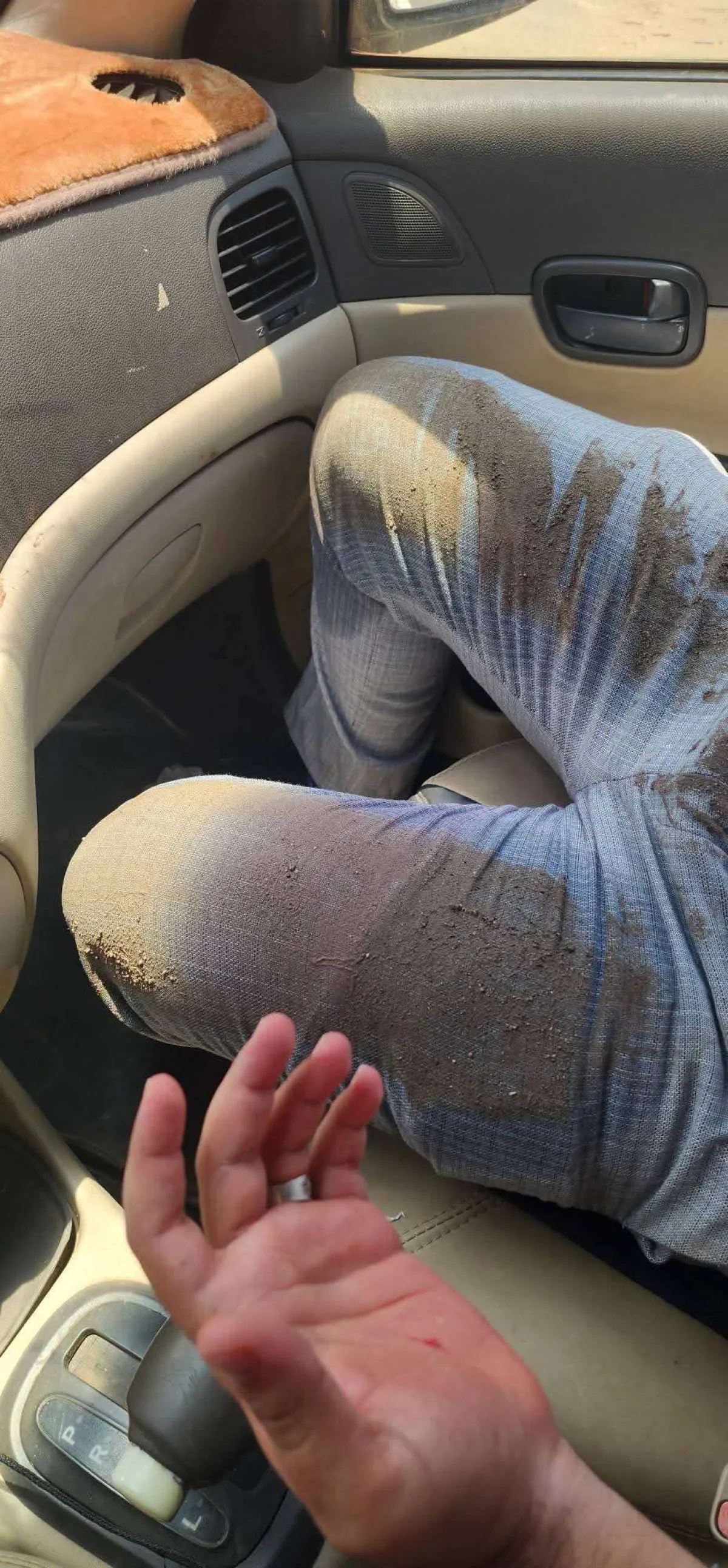 إصابة ناشط إثر سقوطه في حفرة صرف صحي في خور مكسر