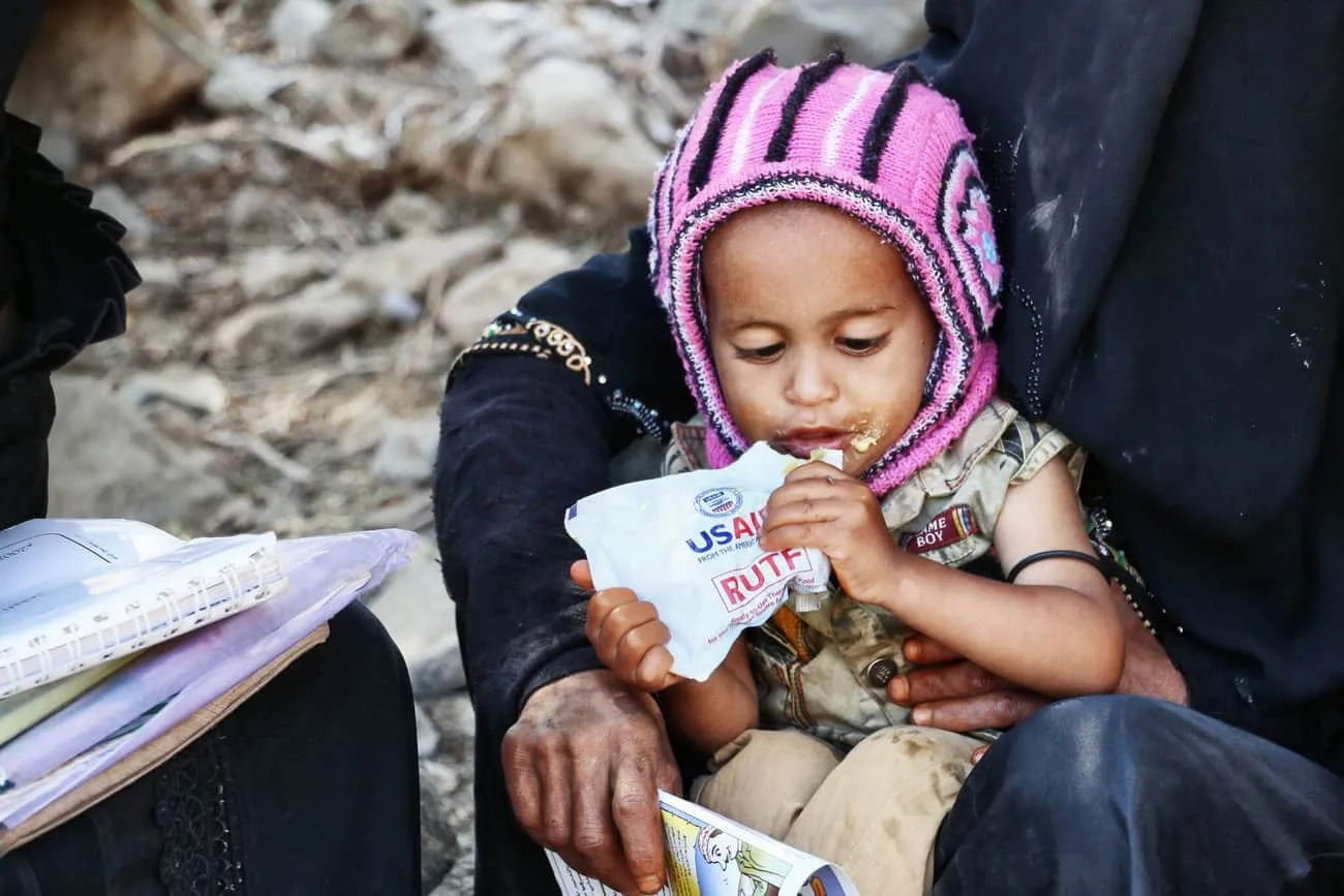 الأمم المتحدة تحذر من تفاقم الأزمة الإنسانية في اليمن مع حاجة أكثر من 22 مليون شخص للمساعدات 