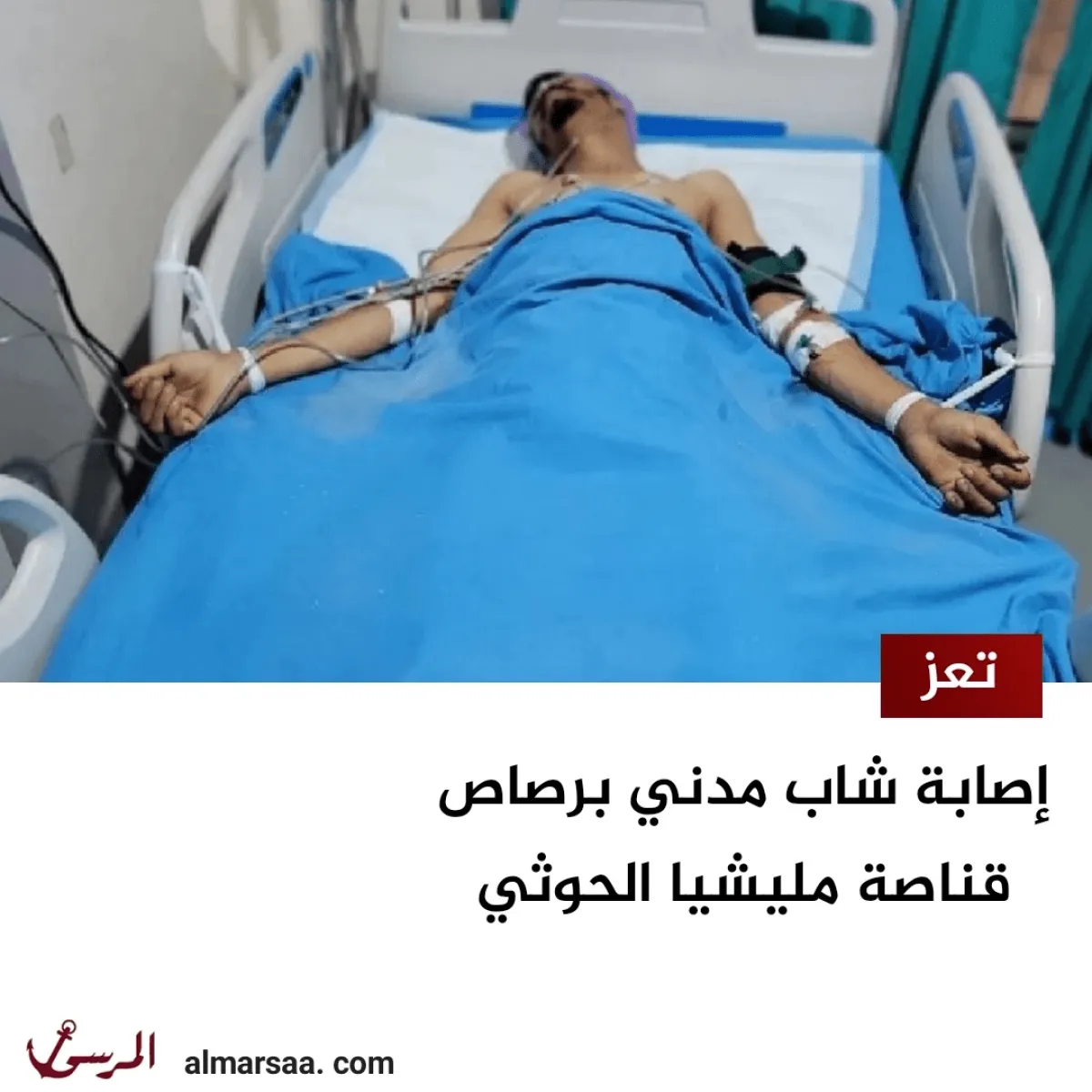 تعز.. إصابة شاب مدني برصاص قناصة مليشيا الحوثي