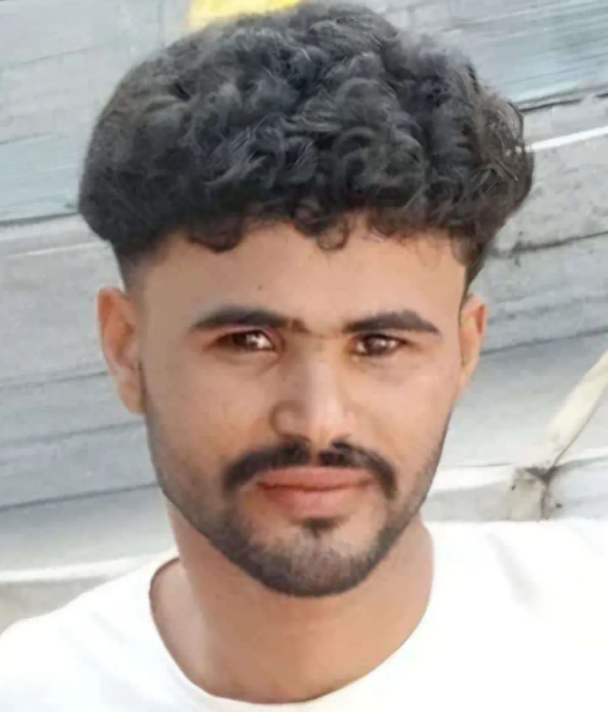 شاب في عدن يتوفى بعد احراقه وهو نائم 