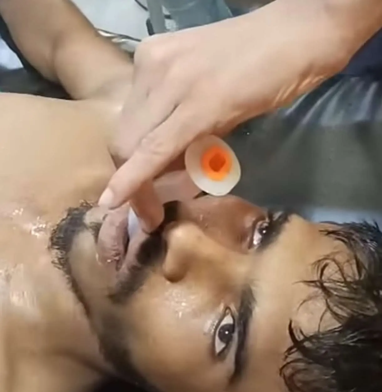 الشاب ايمن بين الحياة والموت عقب اعتداء جنود عليه بسبب مطالبته لمحل صرافة بمبلغ ٧٠ الف بعدن