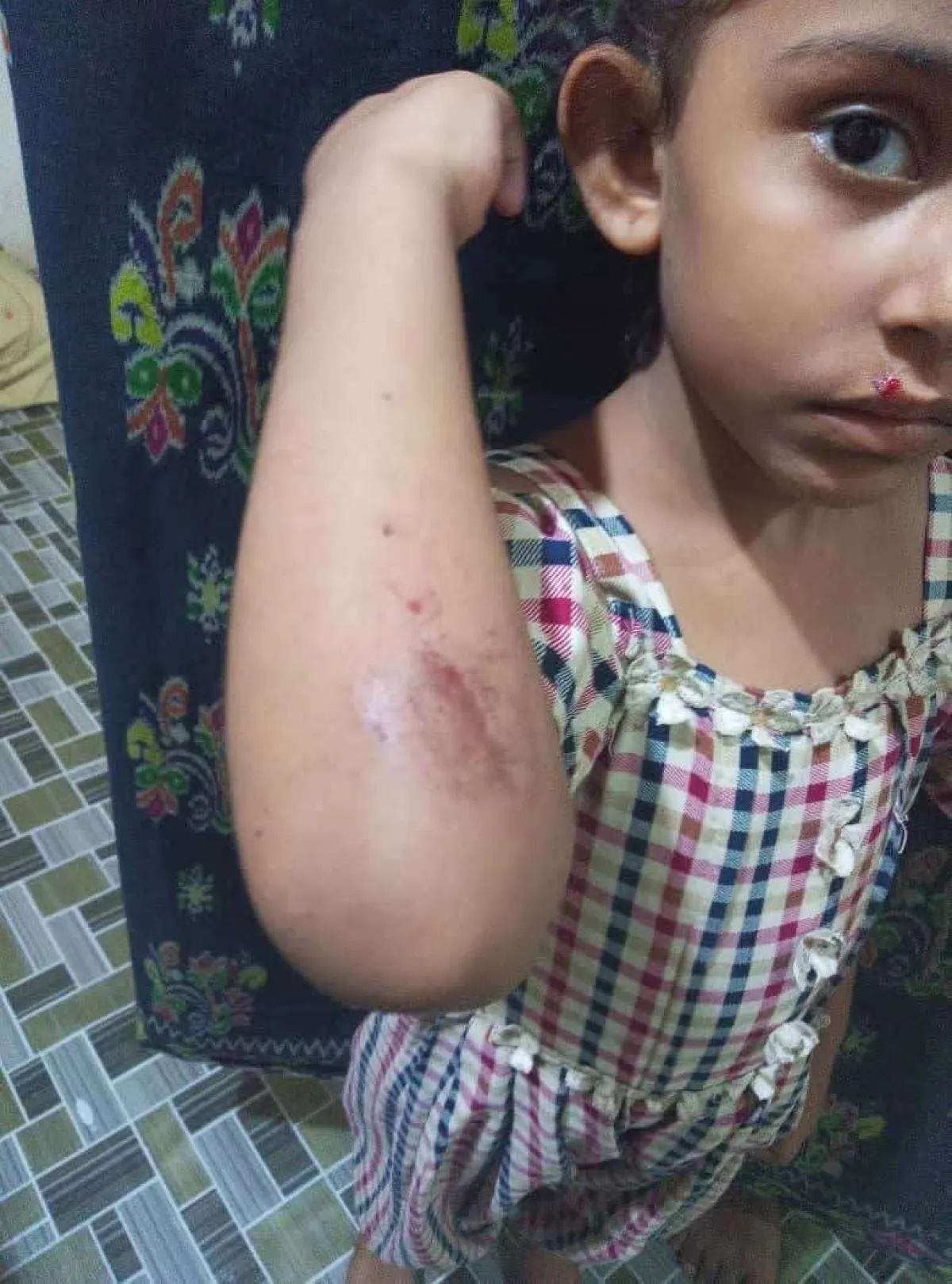 نجاة طفلة من هجوم كلاب ضالة في حوطة لحج ومطالبات بتحرك عاجل