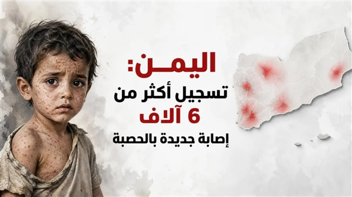 بينها 25 حالة وفاة.. تسجيل أكثر من 6 آلاف إصابة بالحصبة في اليمن خلال 3 أشهر