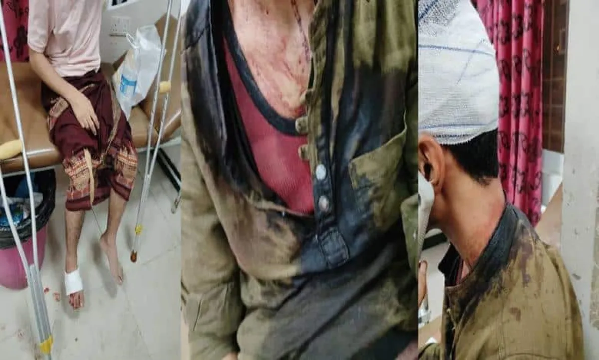 طلاب من المخا يتعرضون لاعتداء جماعي في تعز وسط مطالبات بضبط المتورطين