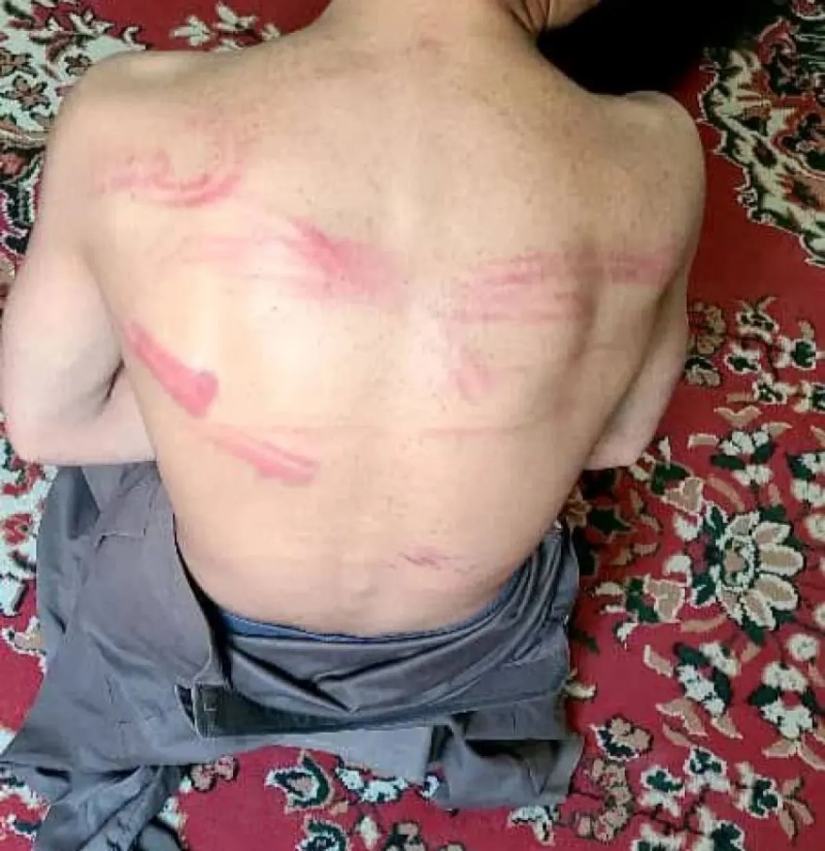 قيادي حوثي يشرف على تعذيب طفل «14 عاما» بصورة بشعة في أحد المعتقلات بضحيان صعدة