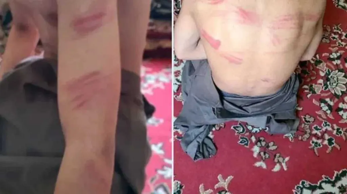 شبكة حقوقية تدين جريمة حوثية بحق طفل قاصر في صعدة