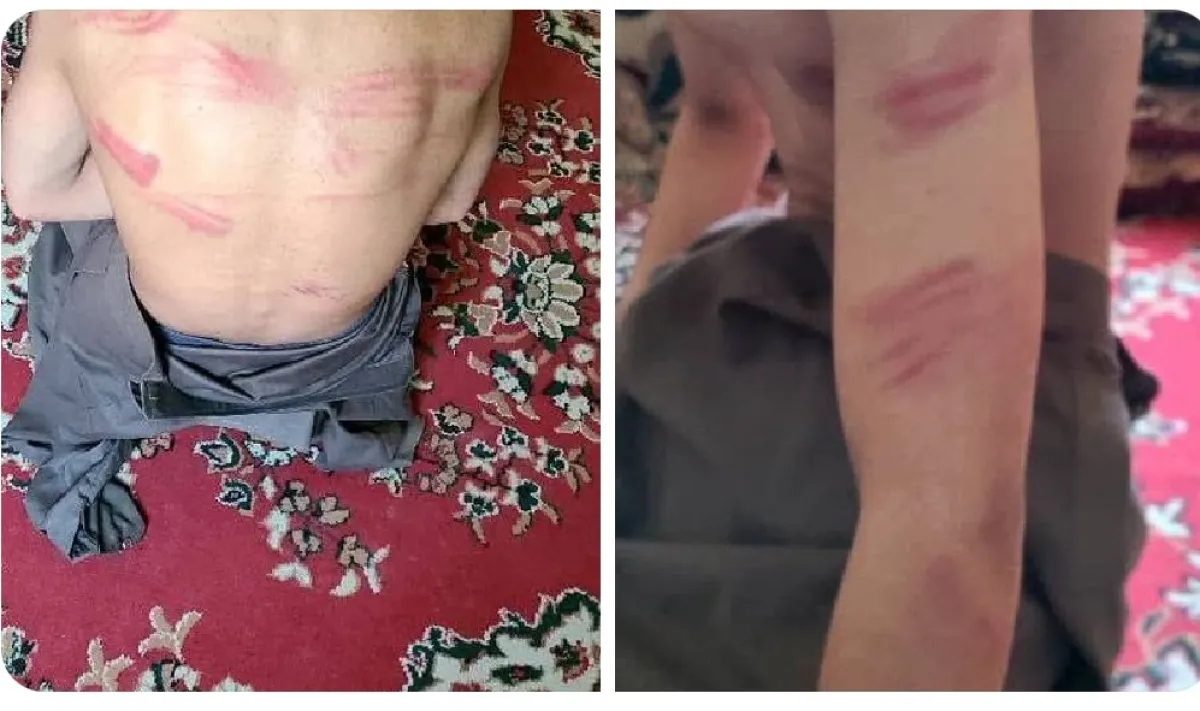 صعدة.. قيادي بمليشيا الحوثي يختطف ويعذب طفلا في ضحيان