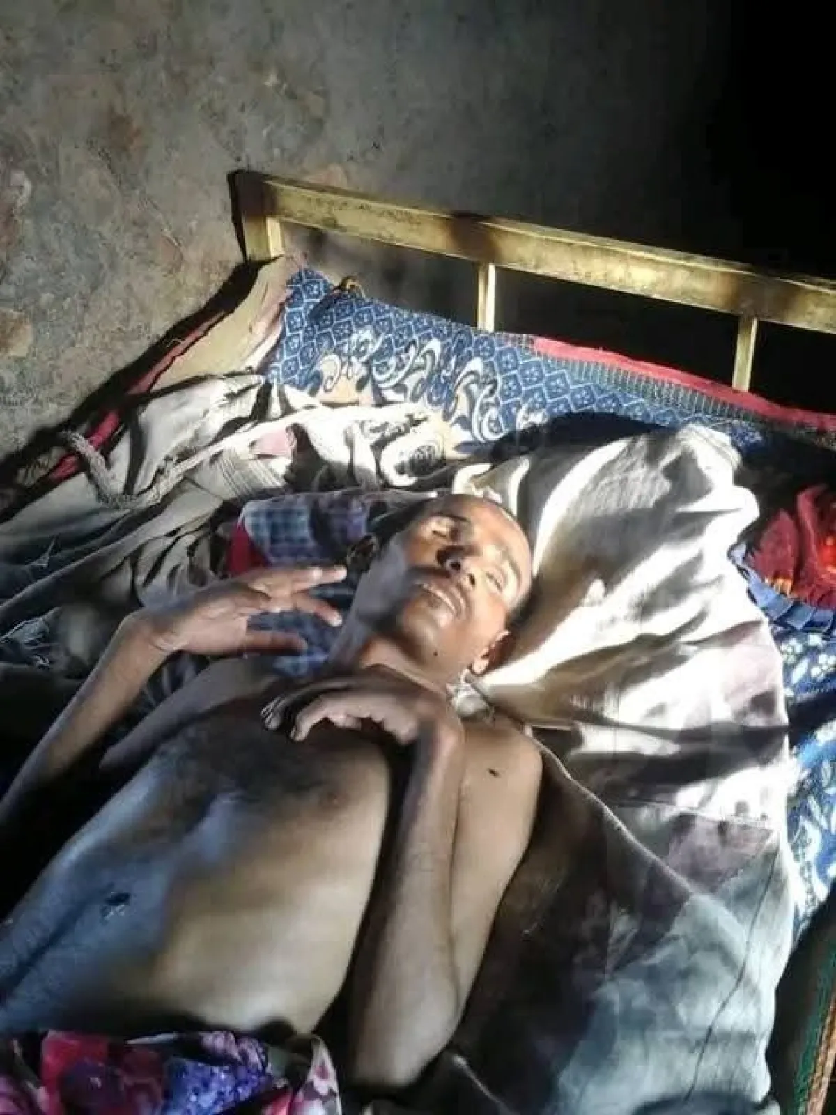 مناشدة لعلاج جريح حرب من أبناء الصبيحة يعاني من إصابة خطيرة منذ 11 عاما 