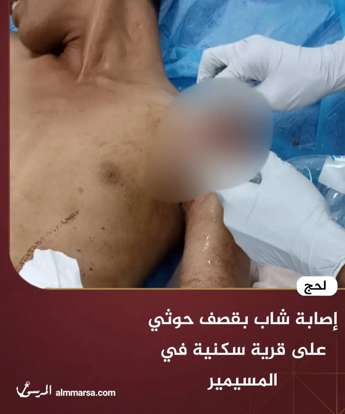 إصابة شاب بقصف حوثي على قرية سكنية في المسيمير- لحج