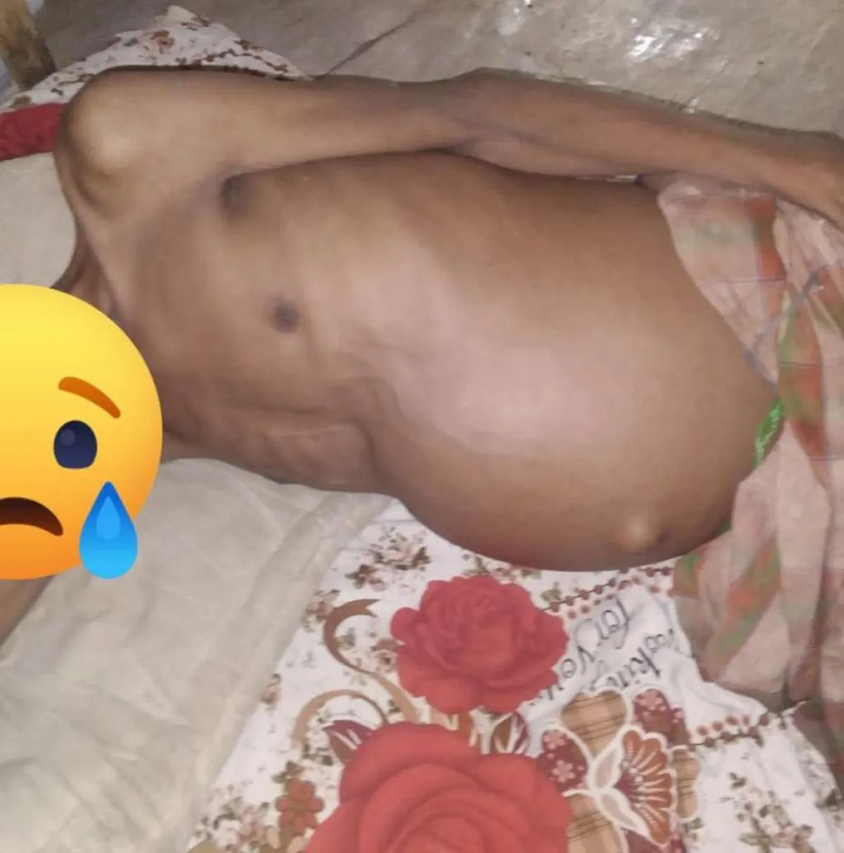 مأساة شاب تهز القلوب في كريتر