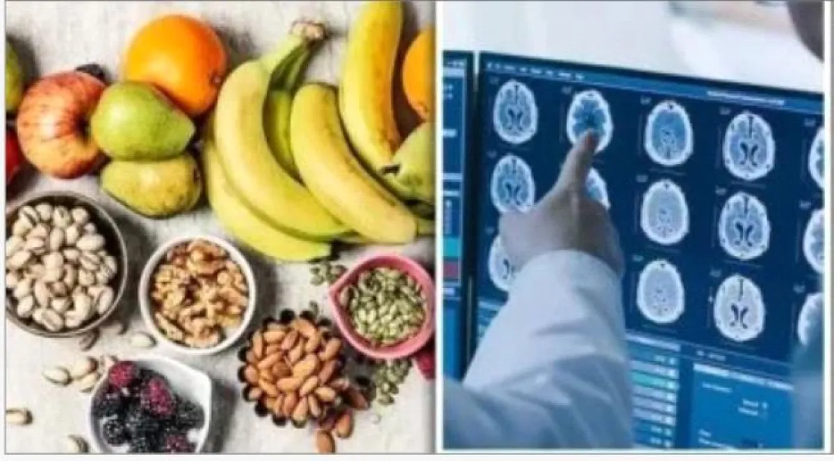 لحماية الذاكرة.. 8 أطعمة تقلل خطر الخرف