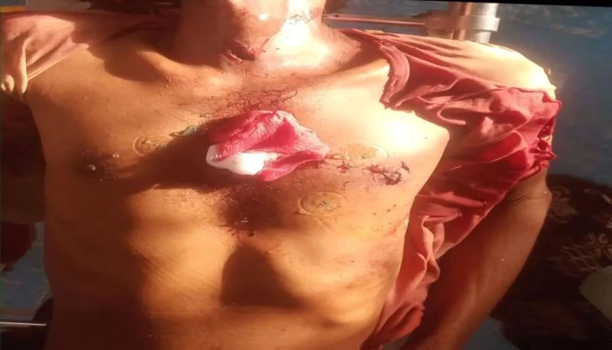 سمكة "أبو سيف" تهاجم صياد أثناء عودته من رحلة رزق وتخترق صدره وتقتله بساحل الخوخة