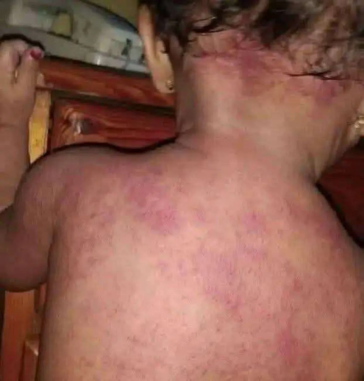 تعليق اسرائيلي لانقطاع الكهرباء بعدن