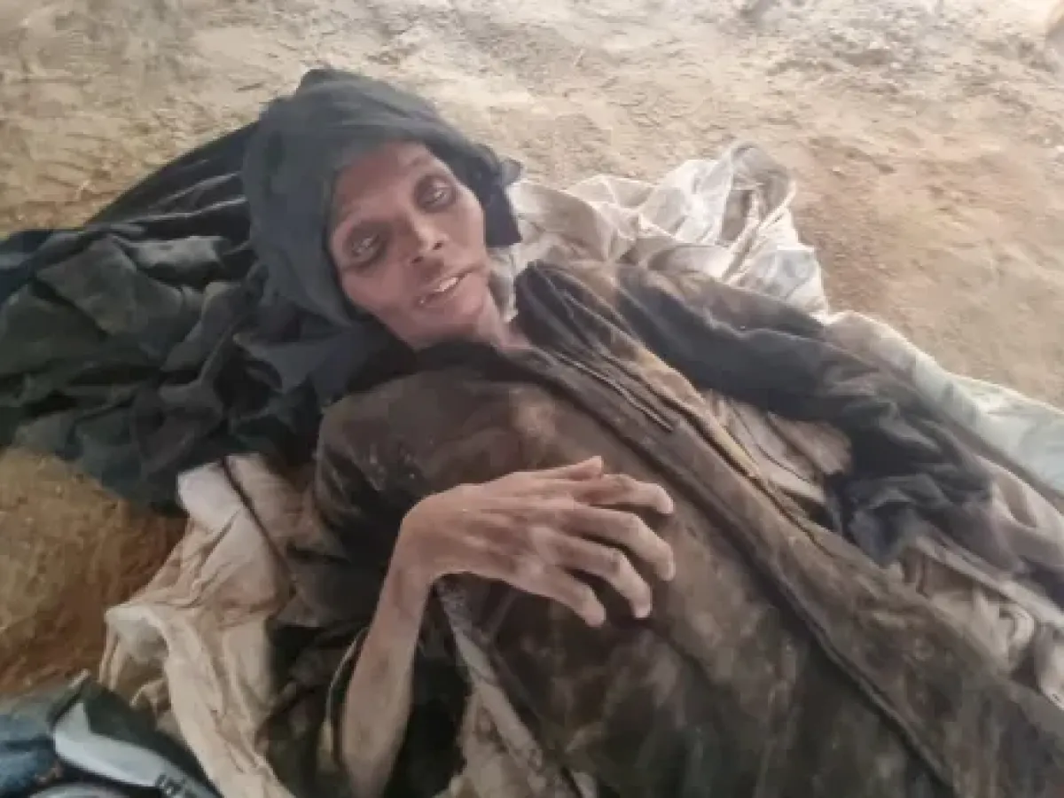 الجوع يفتك بالنازحين في حجة.. وفاة امرأة بعد أسابيع من رحيل زوجها